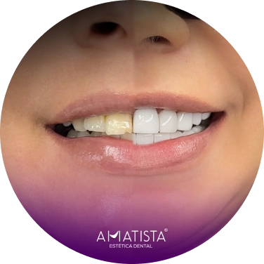 Sonrisa